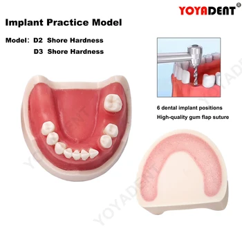 Zobu Implantācija Modeli Zobiem Modeli, Stomatoloģija, Implantācija, Mācību Gumijas Šuvju Mācību Pētot Produktu Zobārsts Materiāls